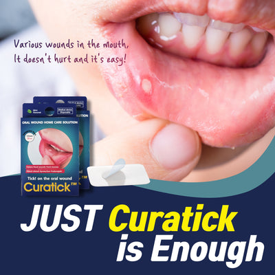 Mouth Ulcer & Canker Sore Relief in the UK – Curatick’s Innovative Oral Wound Care Solution