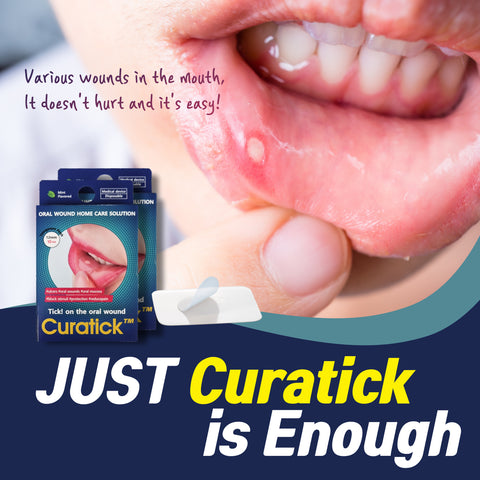 Curatick™ - The Ultimate Solution for Mouth Ulcers and Oral Wounds